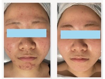 ユイット ルッカ(Huit Lucca)/アクアダーマ