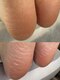 ヴィエル ネイル(VIEL NAIL)の写真/削るだけじゃない！【韓国式足裏角質スペシャルケア】で長年蓄積したかかとの角質をごっそり除去☆