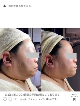 エムアンドエム(M&M)/