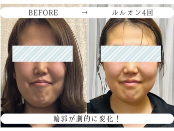 ヨサパーク ノワール(YOSA PARK Noir)/ルルオン4回