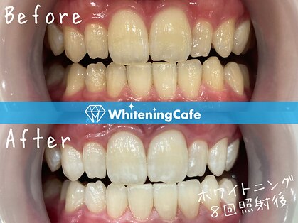 ホワイトニングカフェ 鹿児島中央駅前店(WhiteningCafe)の写真