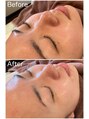 エムスラッシュアヴェダ 自由が丘(M.SLASH AVEDA)&nbsp;スキンケアWAX１回目の効果♪（個人差あります）