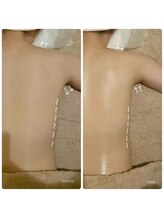 サロン ド サッコ(salon de sacco)/30代女性／全身のむくみ感・腰痛