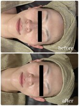 ジャスミン(Jasmin)/エステティック×シェービング