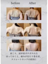 ウル(URU.)/肩甲骨、肩まわりスッキリ！