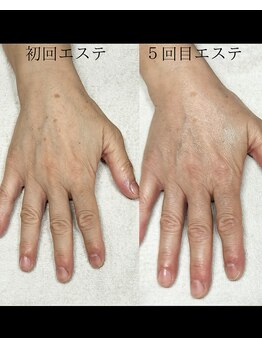 ネイルアンバー 西向田店(Nail amber)/ハンドエステ