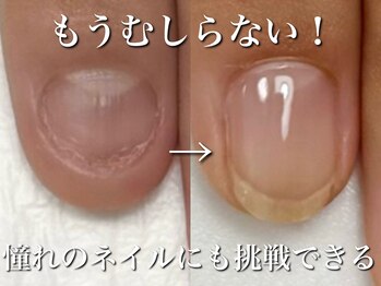 リリー/大学生の５ヶ月の変化