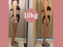 ハッテンビューティーパーク 神戸店(Hatten Beauty Park 810)/ハイパーナイフ痩身