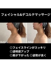 シュ シュ(chou chou)/フェイシャルデコルテマッサージ