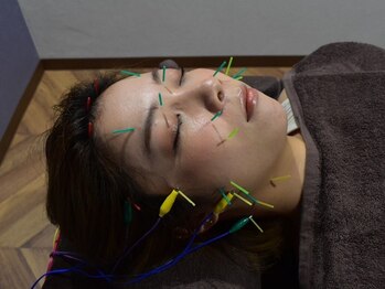 カスミ 本町(kasumi)の写真/凝り固まったお顔を内側からほぐす電気美容鍼灸!小顔矯正と毛穴洗浄の相乗効果で至高の美肌へ導きます★