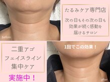アキ