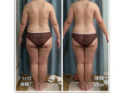 アクア(AQUA)の写真