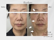 ニーマルイチ(201)の雰囲気（細胞レベルで改善！専門機関も驚きの最新美容ケア◎）