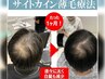 【本格頭皮ケア】グロッティ×ヒト幹細胞★WOTTヘッドスパ★ハリコシ増