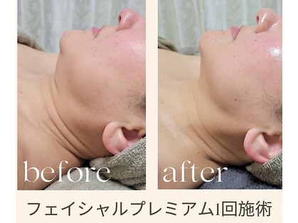 パーソナル ユニ(uni)の写真