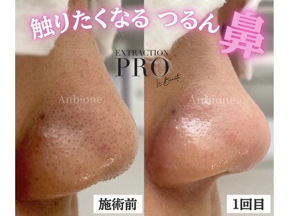 アンビワン(Anbione.)の写真