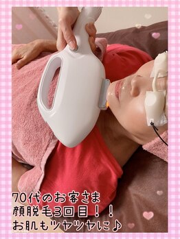 リーベ(Liebe)/年齢問わず大人気のお顔脱毛