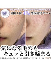 エリス(ELISSE)/フェイシャルワックス