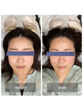 ハリ トモカ 南浦和サロン(HARI TOMOKA)/