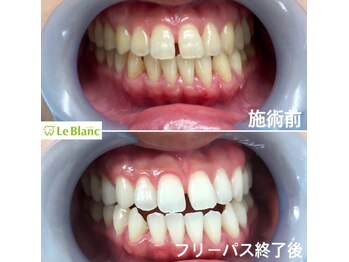 ルブラン 奈良店(Le Blanc)/貴方も変われます！