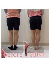 スタイルラボ高松/産後骨盤矯正の効果♪