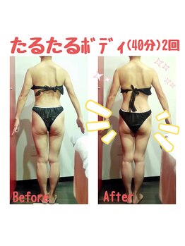 ビューティサロン キヨの部屋(beauty salon)/【たるたる たるみさんコース】