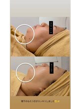 クレール 小山店(CLAIR)/【二重あご・むくみ改善】