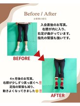 健康塾キューオーエル 恵比寿(QOL)/ビフォーアフター写真(70代女性)