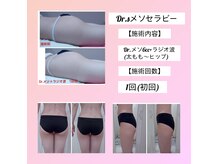 クリニカルエステ イーズ イオンモール筑紫野店の雰囲気（Dr.メソ＆ラジオ波で部分的な太ももや二の腕もすっきり）
