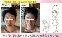 コメット(Comete)