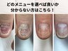 【深爪矯正/自爪育成】どのメニューを選べば良いか分からない方はこちら！