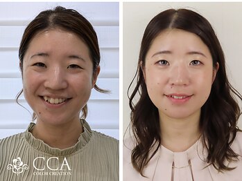 カラークリエーション(COLOR CREATION)/ビフォー＆アフター