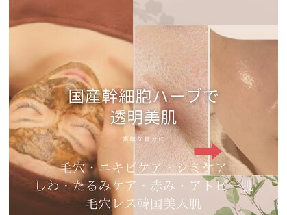 カラーリリー(calla lily)の写真