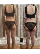 ルノン(LUNON)/温熱リンパドレナージュ