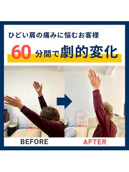 ヒューマンストレッチ 京都錦店(Human Stretch)/腕の硬さから肩の痛みに...