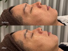 アウラ 小杉店(AULA)/