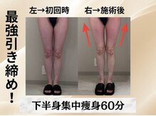 イヨヨ(iyoyo)/BeforeAfter　施術１回