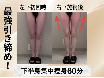 イヨヨ(iyoyo)/BeforeAfter 施術1回