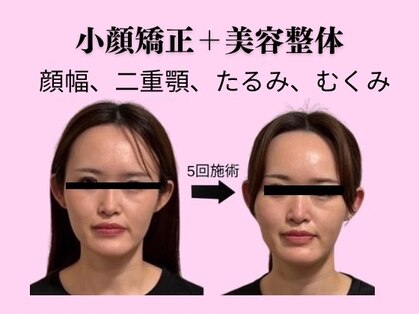 ワンモア 新町店(1MORE)の写真