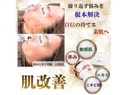 ビエル(Bielle)の写真