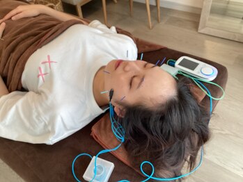 ハリファ鍼灸院 横浜関内院(HariFa鍼灸院)/美容施術