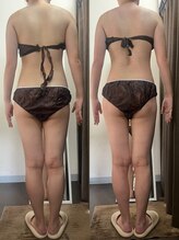 サロンドココ(Salon de COCO)/ハイパーナイフ全身痩身