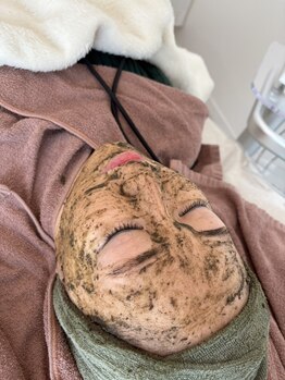 アリス(Alice)の写真/＼宇部市希少！／ニキビケアに特化した TIPハーブピーリングでお肌のお悩みを解決！自身の持てる素肌へ＊