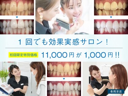 ホワイトニングショップ 長岡京店の写真