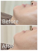 ミヨン ヨコハマ(Miyonne Yokohama)/肌質改善港南台駅/上大岡駅