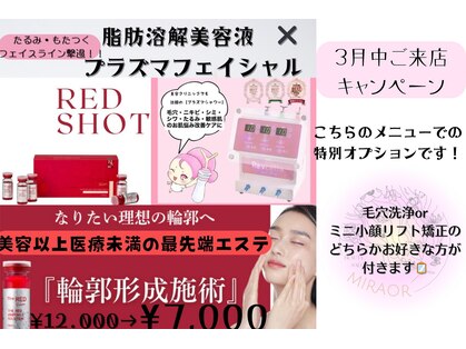 ミラー(MIRAOR)の写真