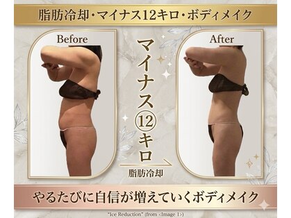 エステティックサロン フェアリー(ESTHETIC SALON FAIRLY)の写真
