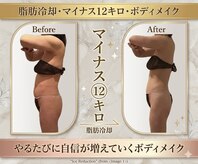 エステティックサロン フェアリー(ESTHETIC SALON FAIRLY)