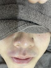 ナノハナ/鹿沼市全身脱毛美容室ナノハナ