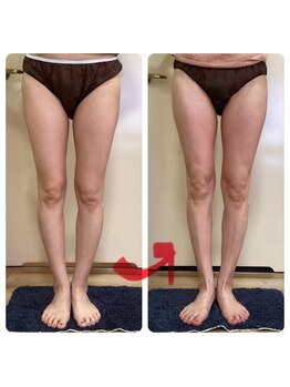 エステティックサロン ココチ(Cocochi)/下半身コルギ